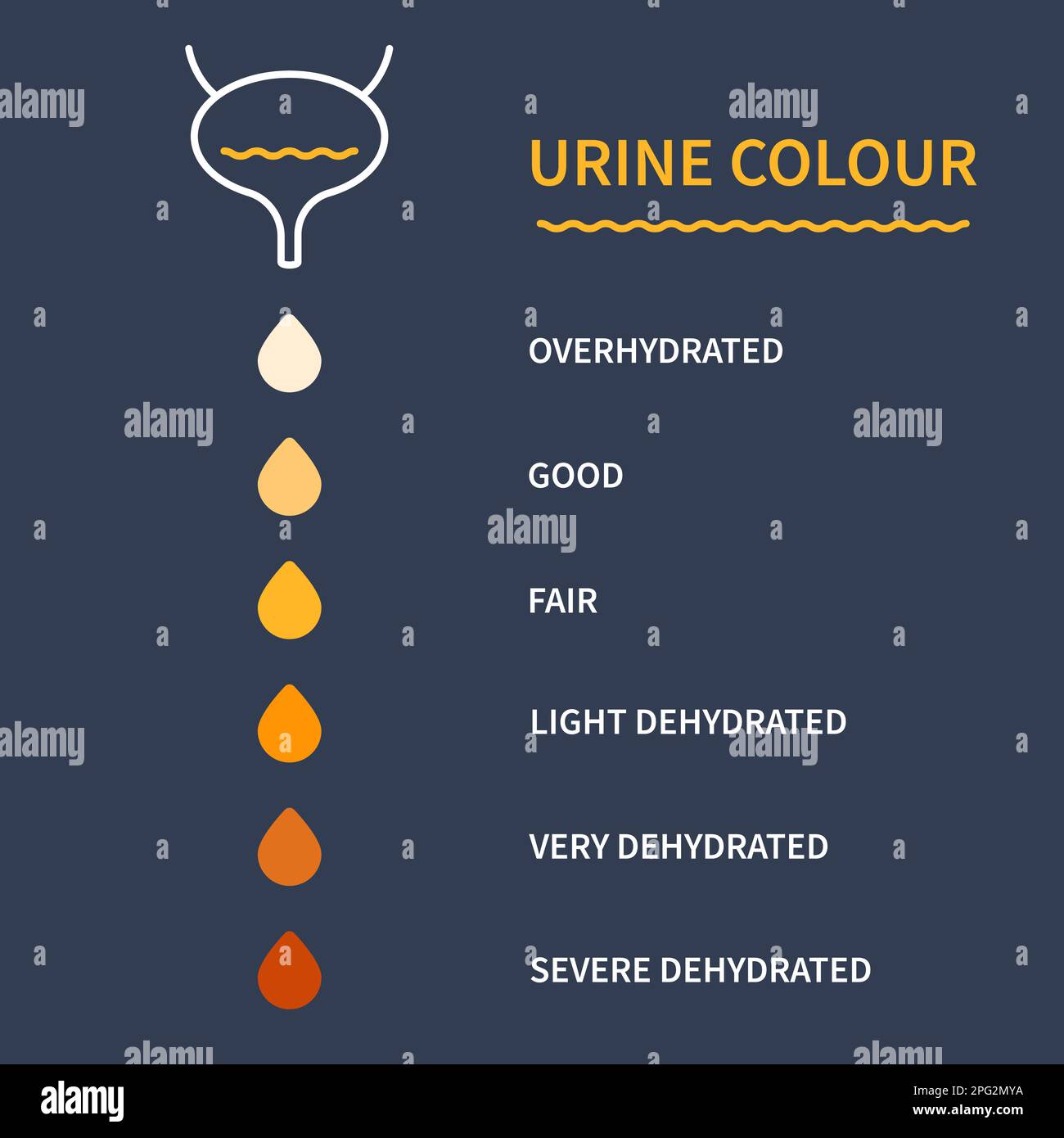 Urine Color Chart Illustration Of Dehydration Level Stock Vector Image 