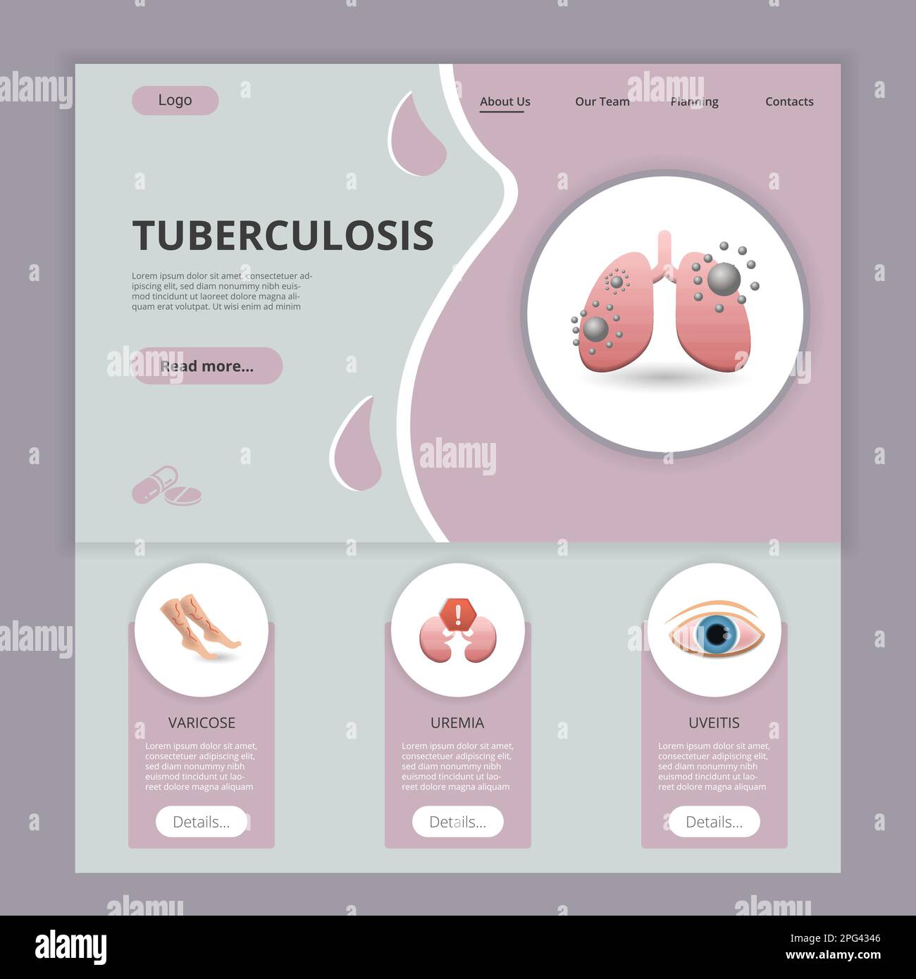 Tuberculosis Templete Tuberculosis flat landing page website template. Varicose, uremia ...