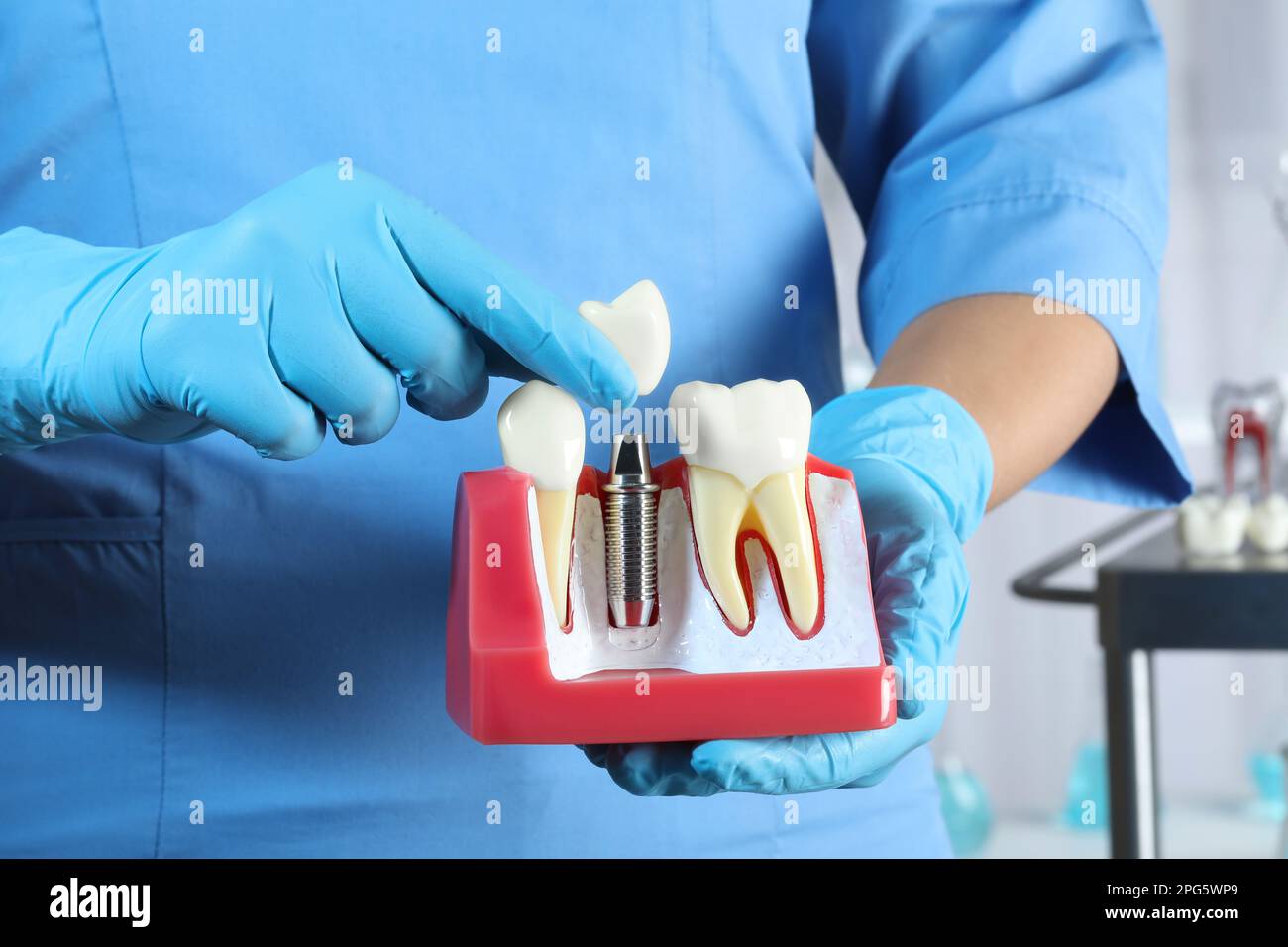 Dentist putting crown onto abutment of dental implant between teeth in