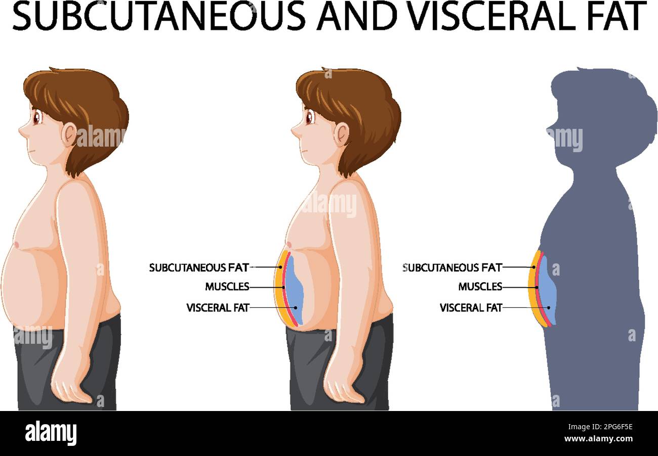 Subcutaneous And Visceral Fat Diagram Illustration Stock Vector Image And Art Alamy 