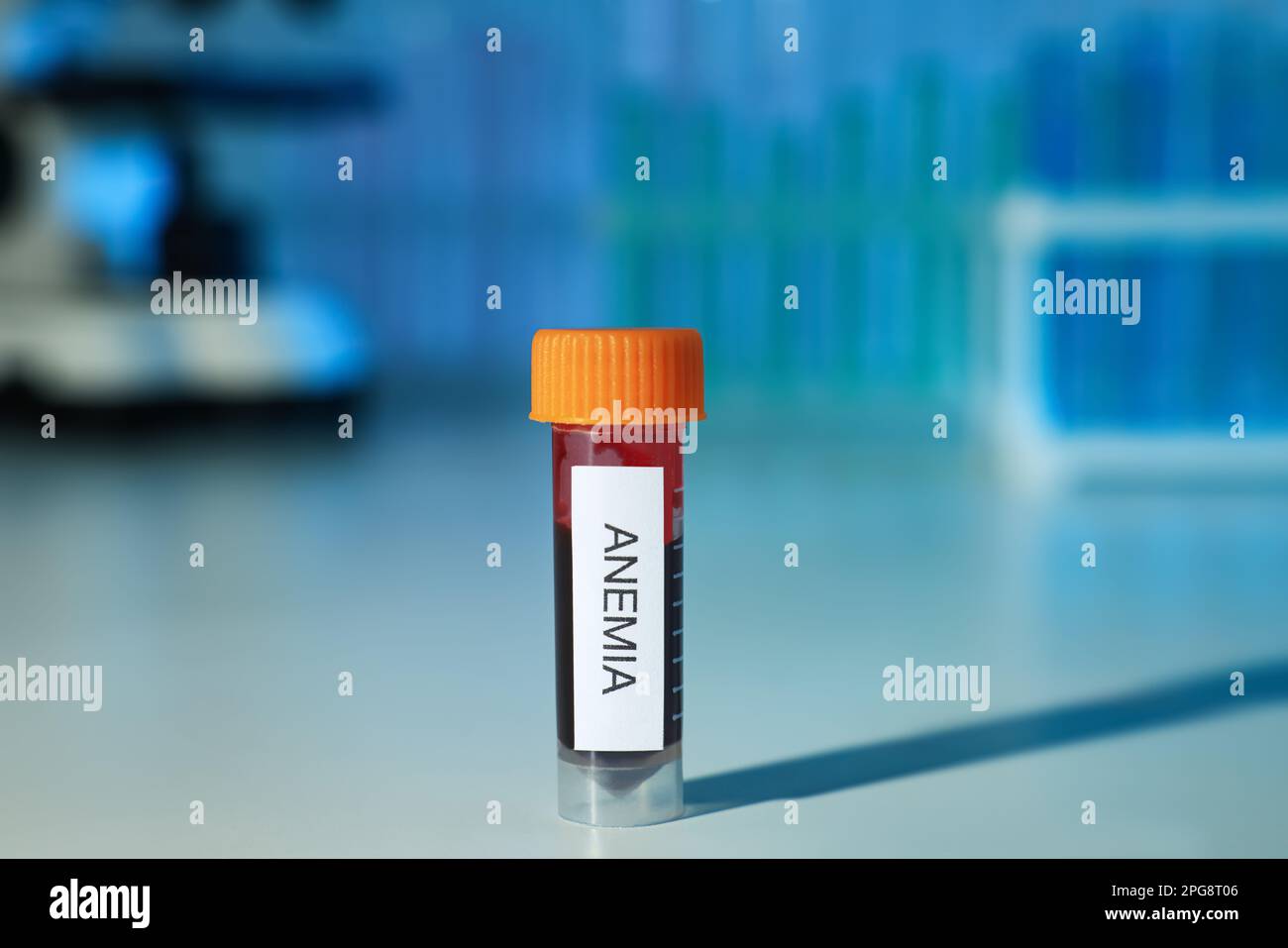 Test tube with blood sample and label Anemia on white table against