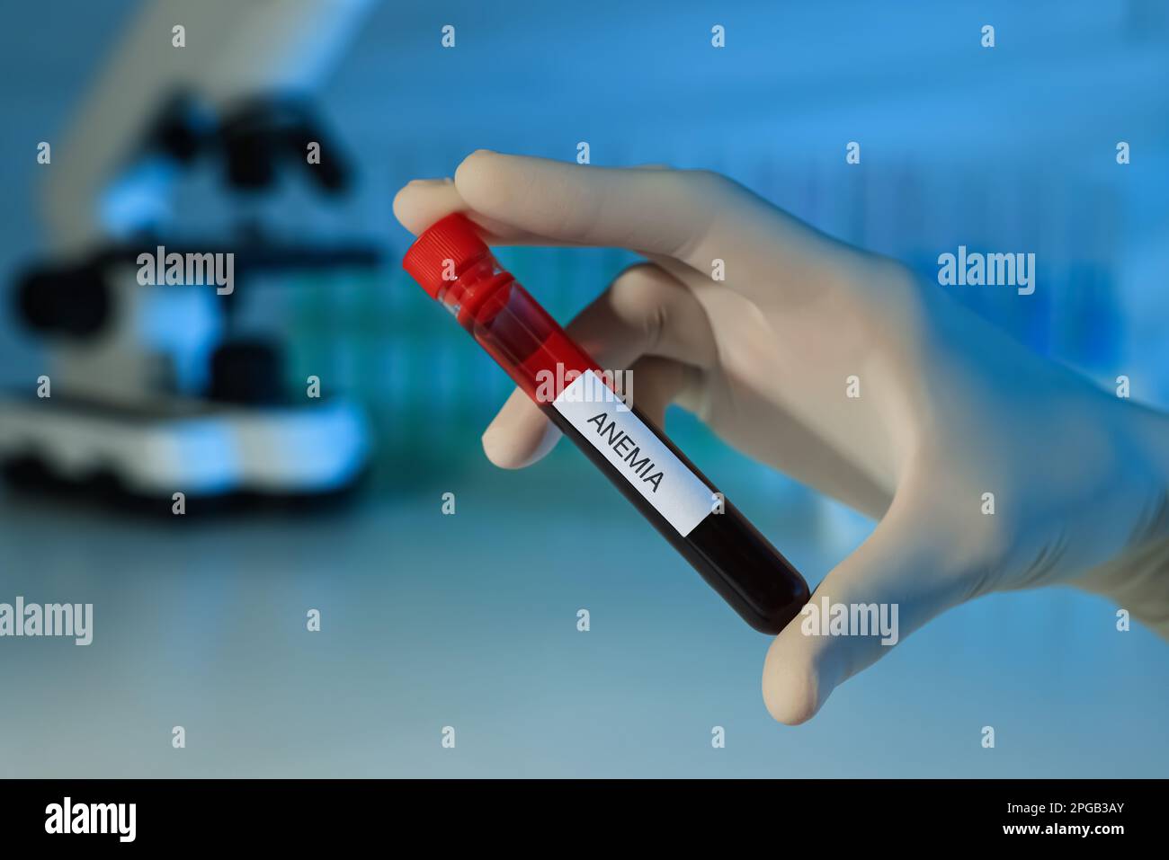 Scientist holding test tube with blood sample and label Anemia on