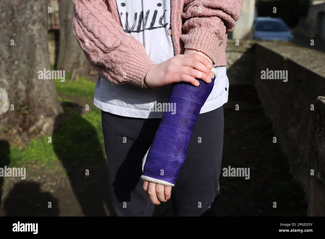 An eleven year old girl pictured with a plaster cast on her broken wrist in Senlis, France. Stock Photo