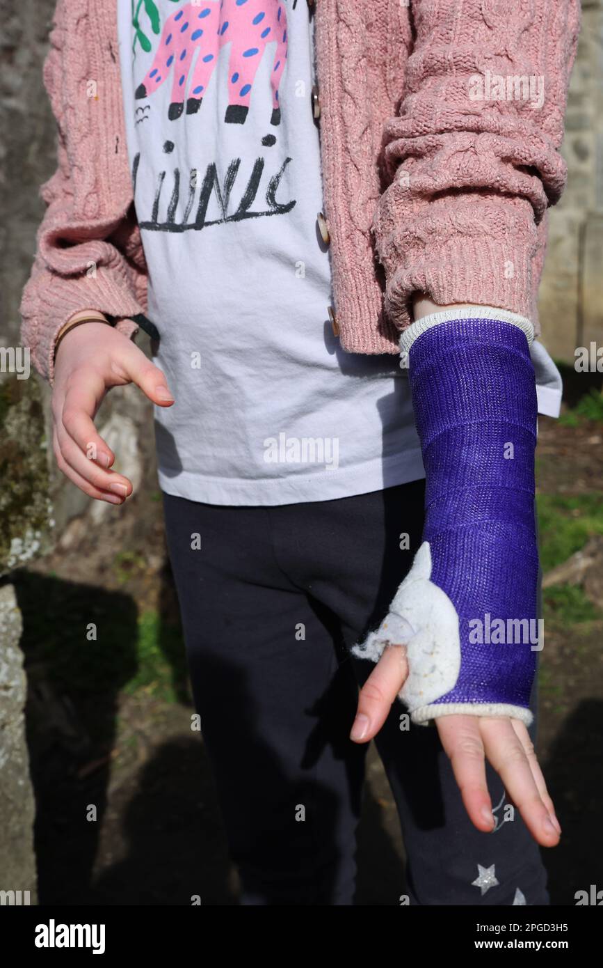 Plaster of paris cast arm hi-res stock photography and images - Alamy