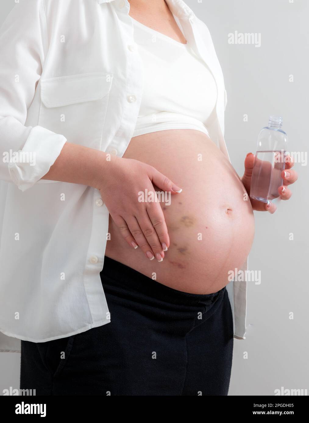 Pregnant woman applying cosmetic oil on her belly for healing puncture