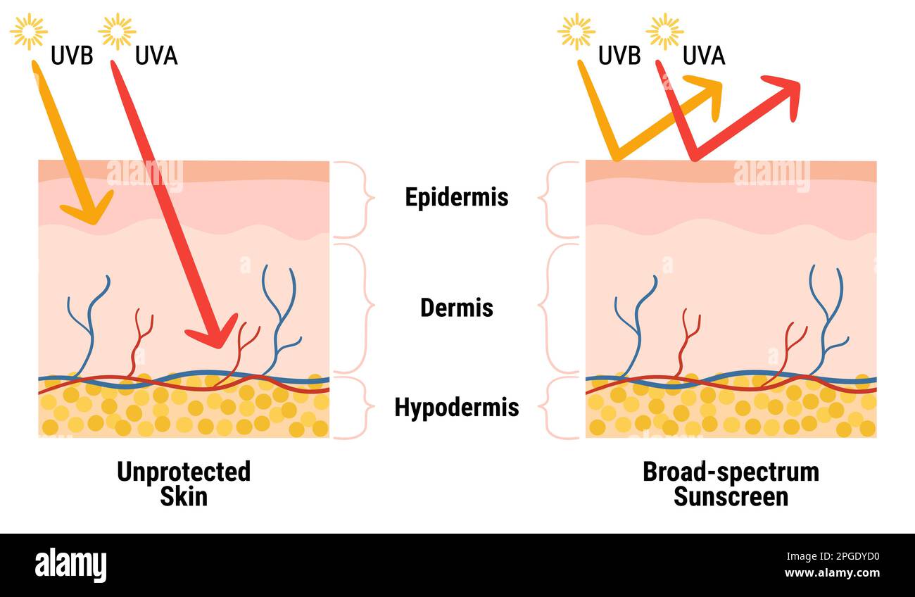 UV into the layers of the skin. Infographic of sunscreen