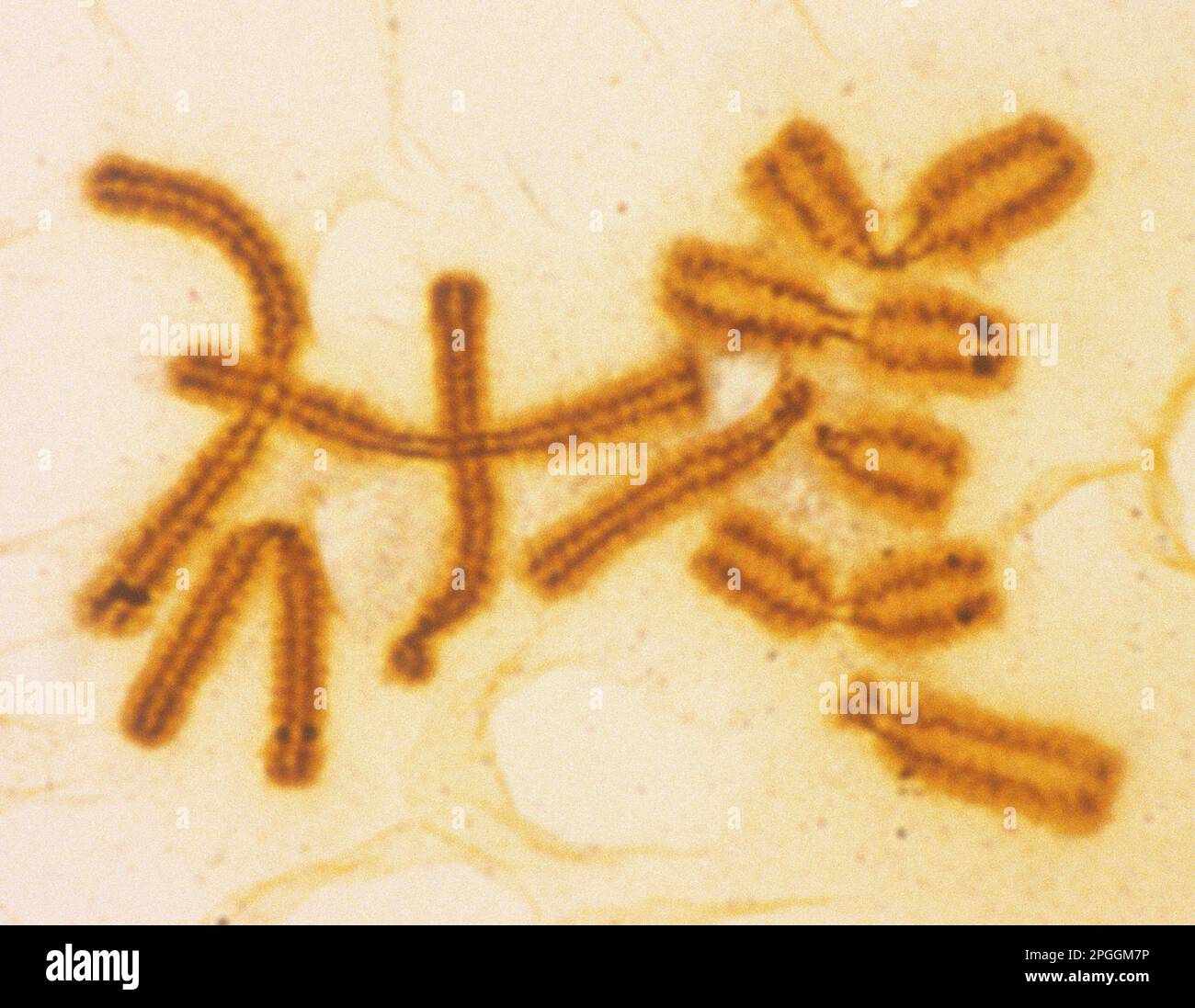 Condensed chromosomes, light micrograph Stock Photo Alamy