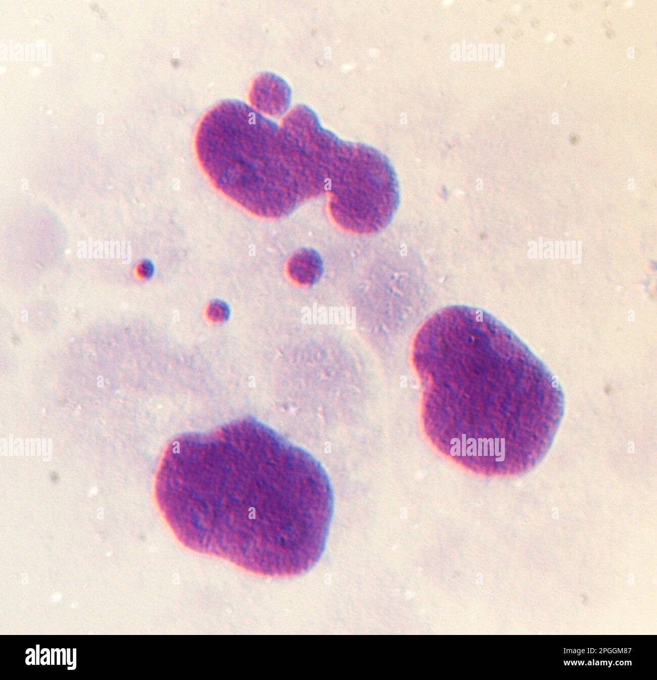 Chromosome missegregation light micrograph Stock Photo Biology Diagrams