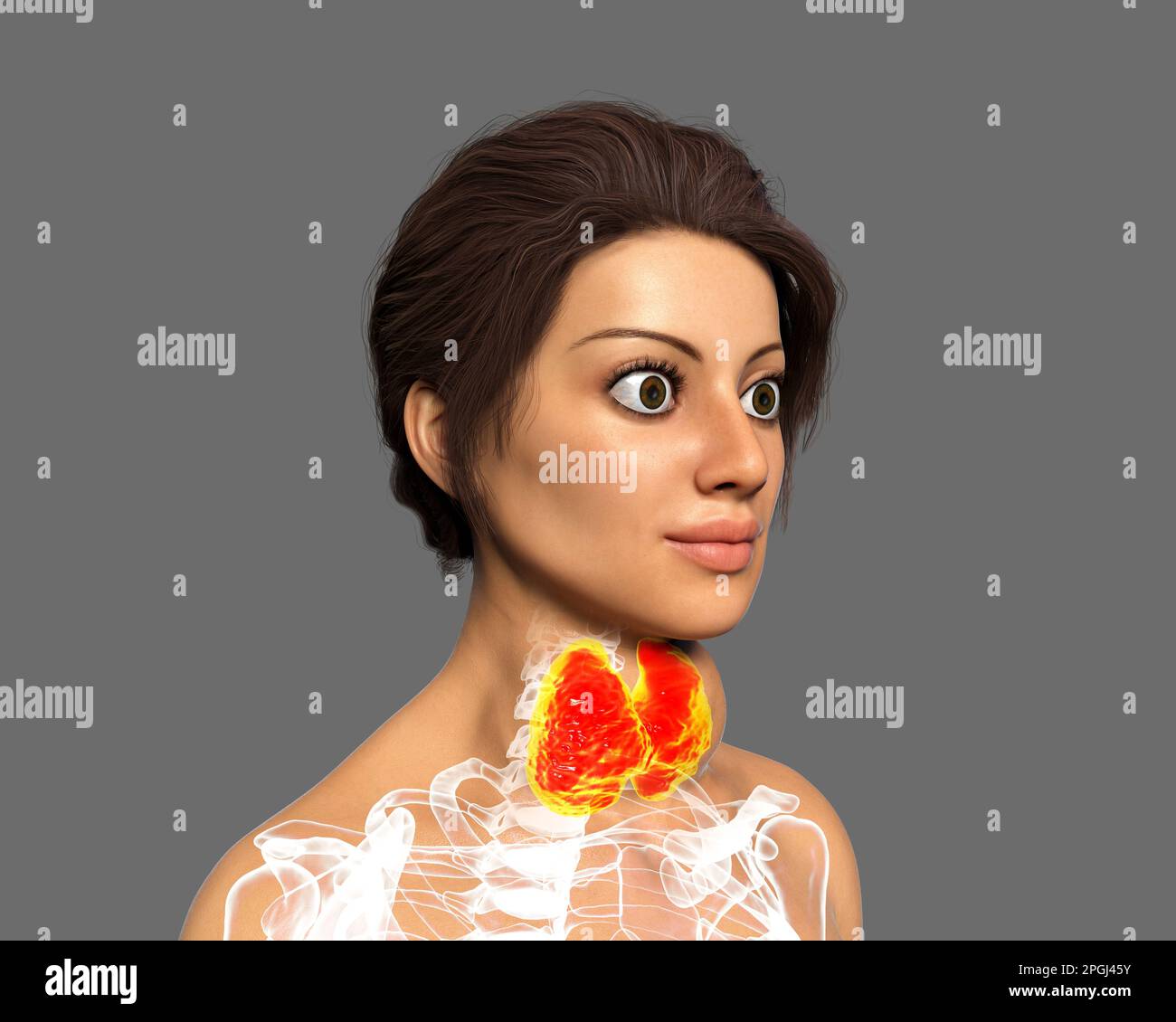 Swollen unhealthy hi-res stock photography and images - Alamy