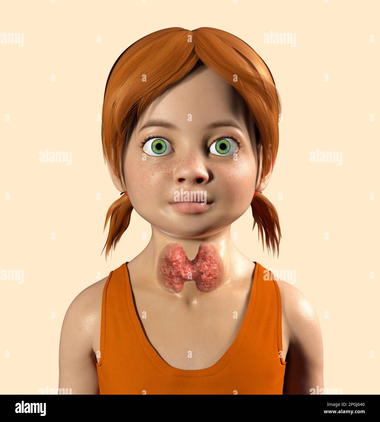 Swollen unhealthy hires stock photography and images Alamy