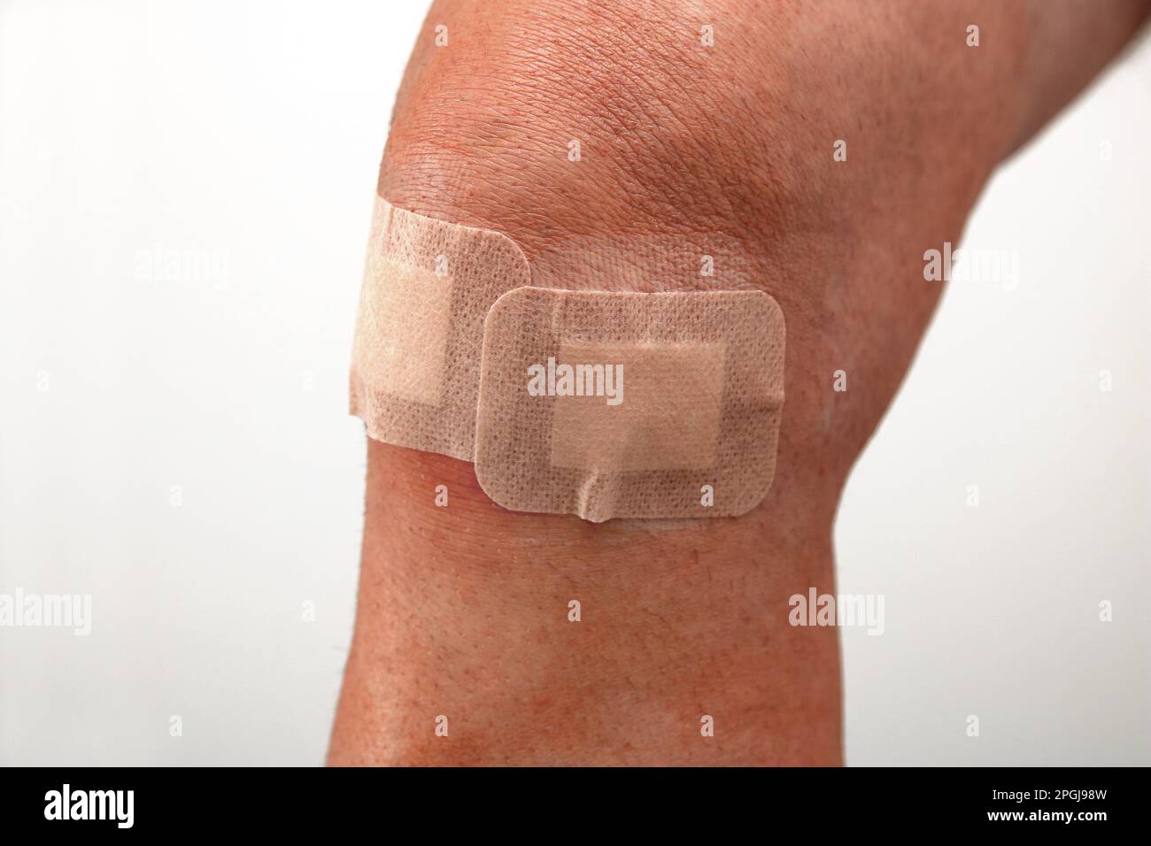 madical tapes on wound sutures after a knee surgery, meniscus repair
