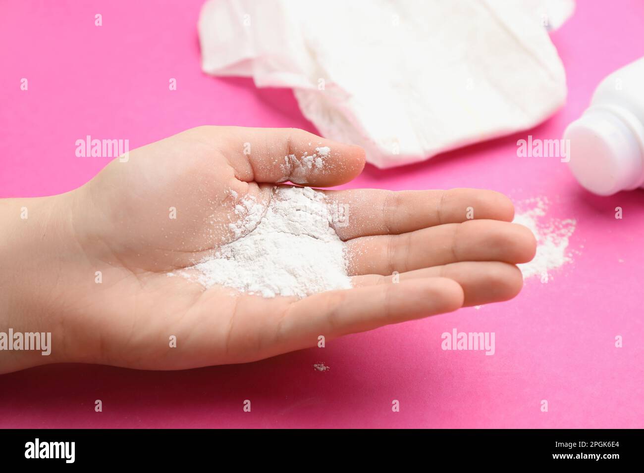 Diaper rash hires stock photography and images Alamy