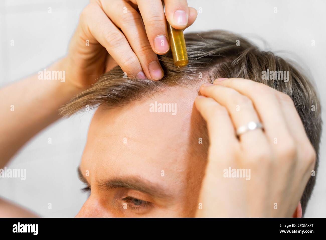 Middle aged caucasian white man uses, applies to hair with cosmetic ampoules with serum for hair growth, restoration beauty hair. Stock Photo