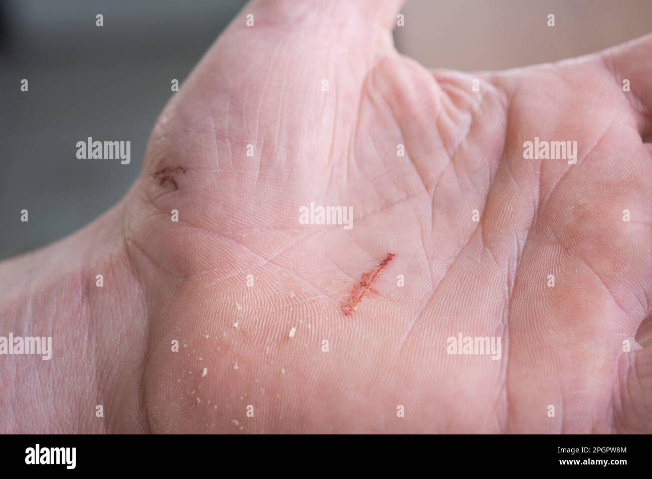 A cut on a man's palm in close-up. Household skin damage with a sharp cutting object, first aid Stock Photo