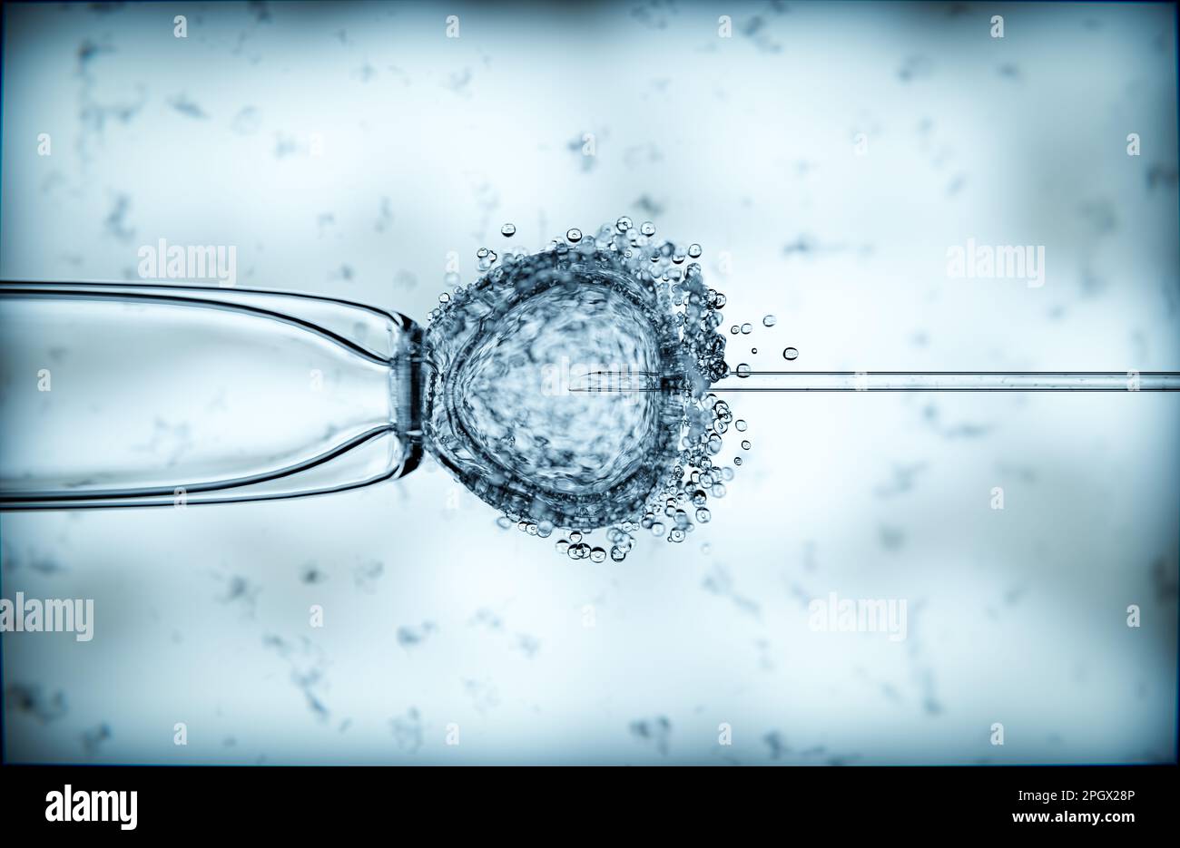 In vitro fertilization with intracytoplasmic sperm injection 3d