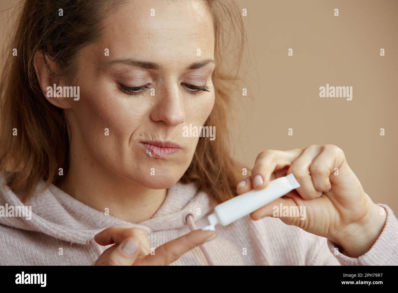 woman with herpes on lips and ointment in a tube isolated on beige. Stock Photo
