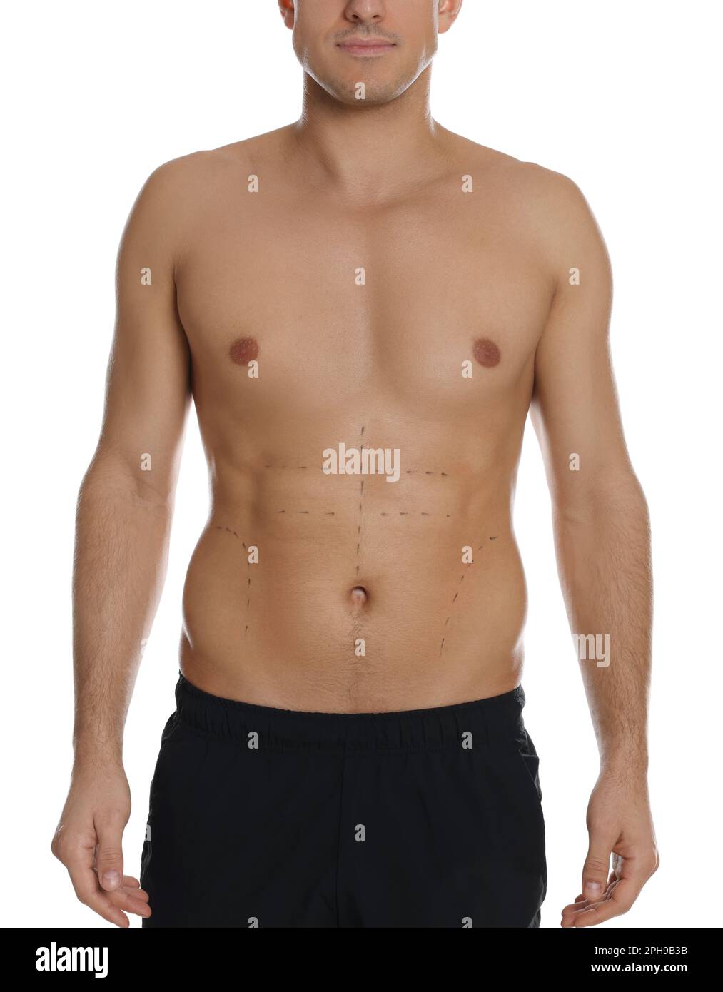 Fit man with marks on body against white background, closeup. Weight loss surgery Stock Photo
