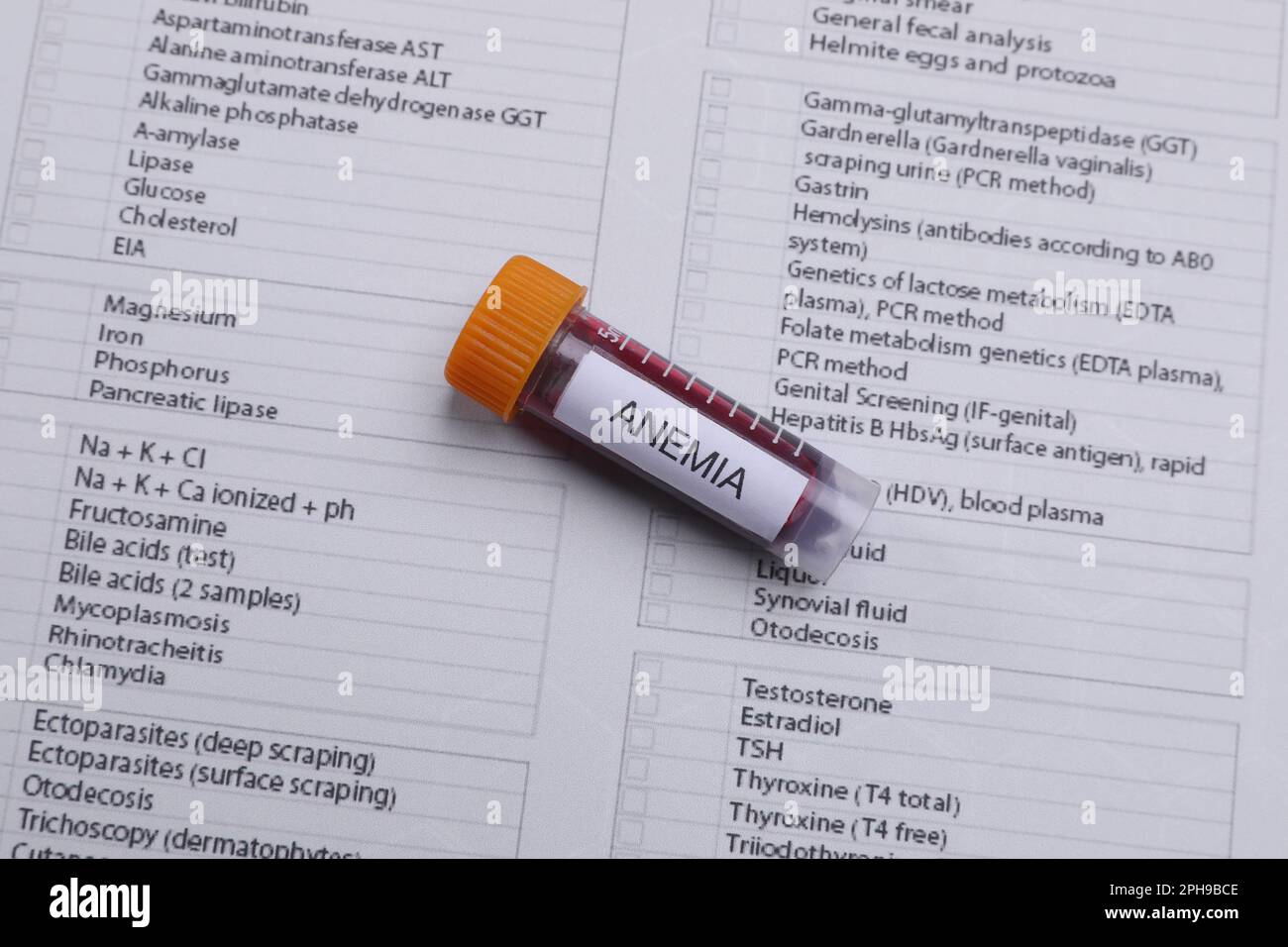 Test tube with blood sample and label Anemia on medical form, above