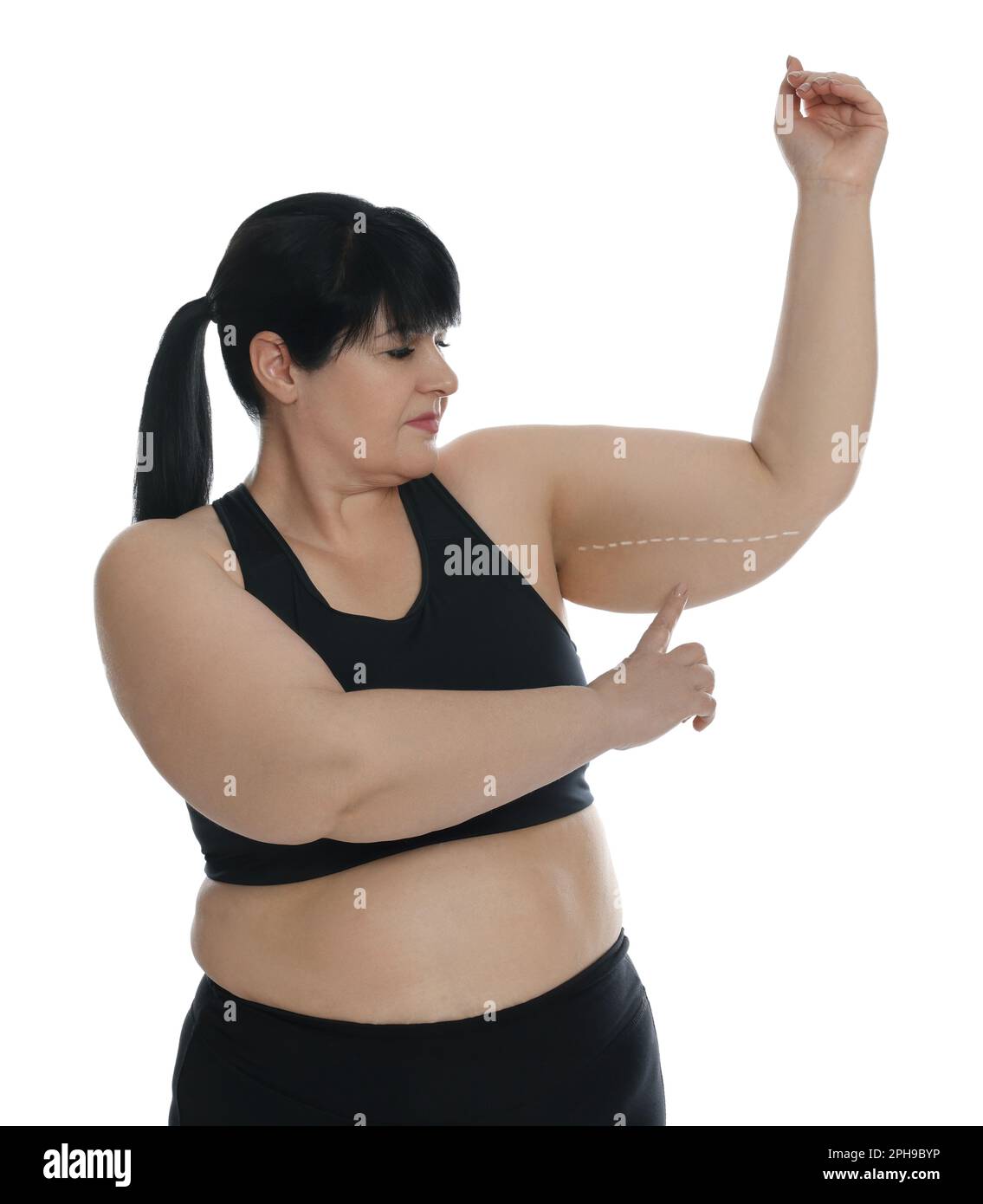 Obese woman with flabby arm on white background. Weight loss surgery Stock  Photo - Alamy