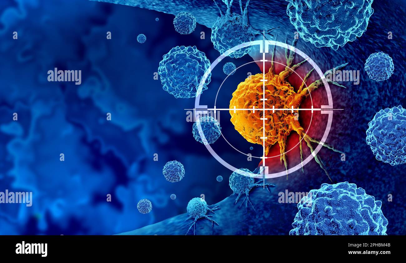 Cancer detection and screening as a treatment for malignant cells with a biopsy or testing caused by carcinogens and genetics with a cancerous cell Stock Photo