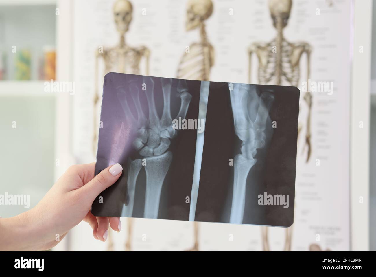 Hand of woman holding x-ray of wrist against skeletons Stock Photo