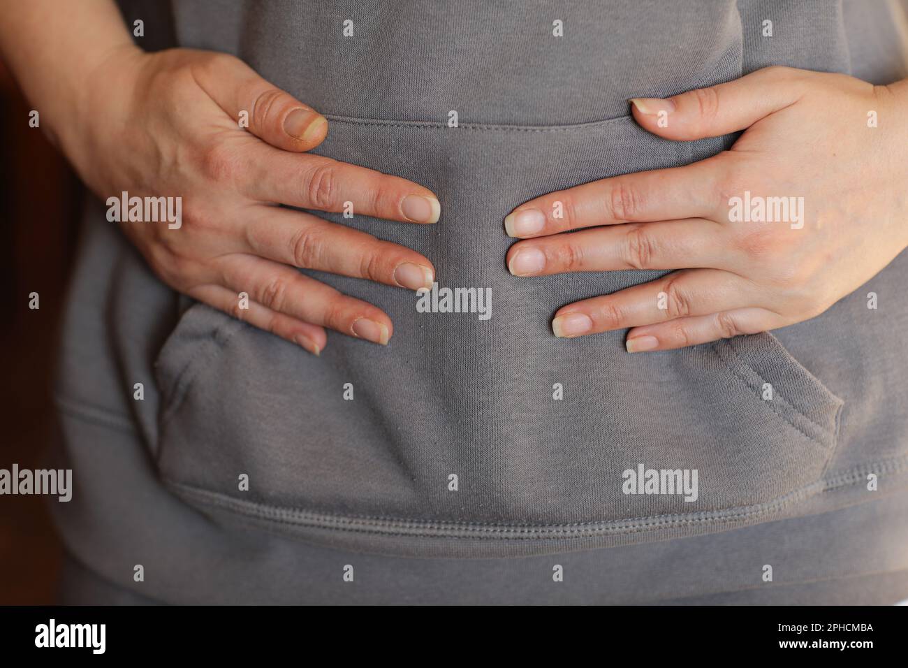 Discolouration of nails after chemotherapy. Hands of cancer patient