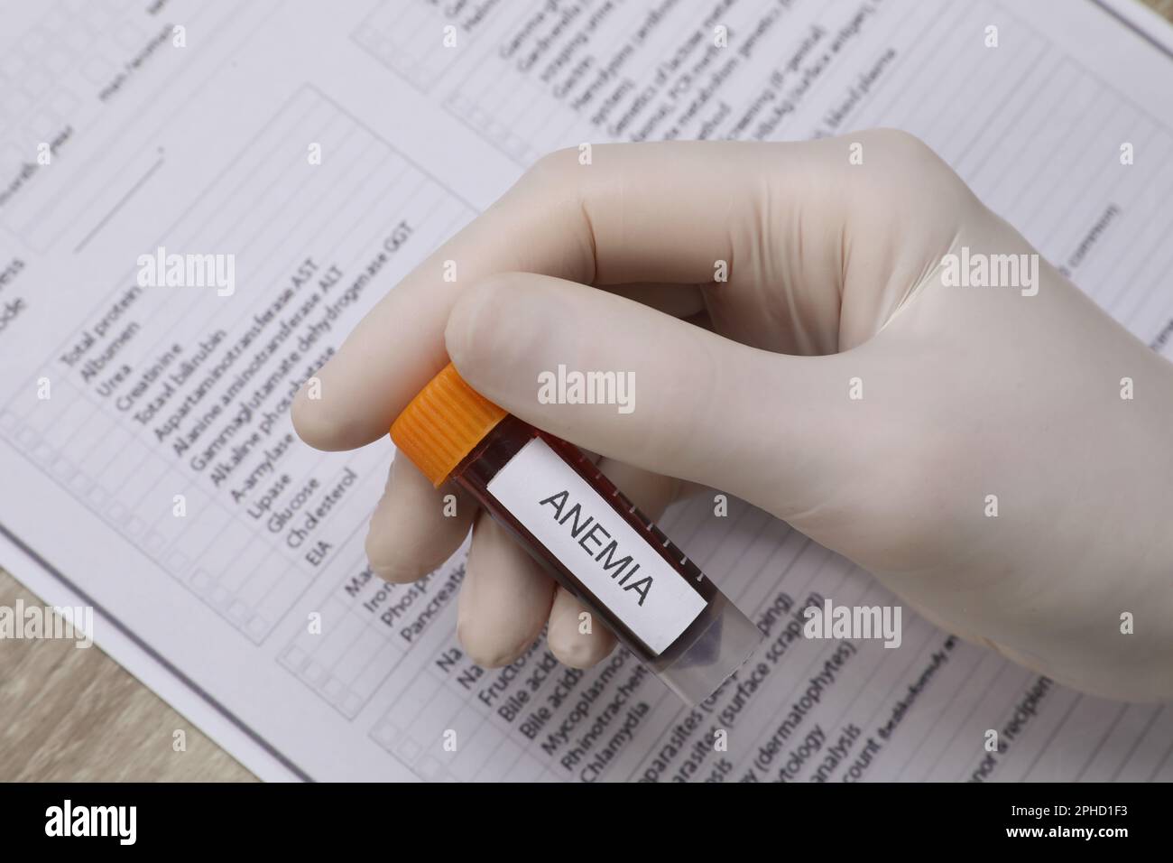 Doctor holding test tube with blood sample and label Anemia over