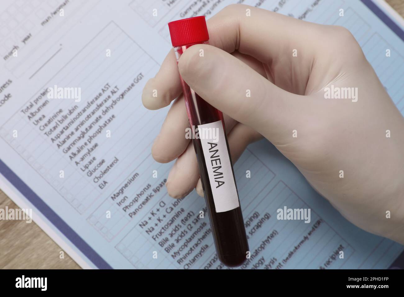 Doctor holding test tube with blood sample and label Anemia over