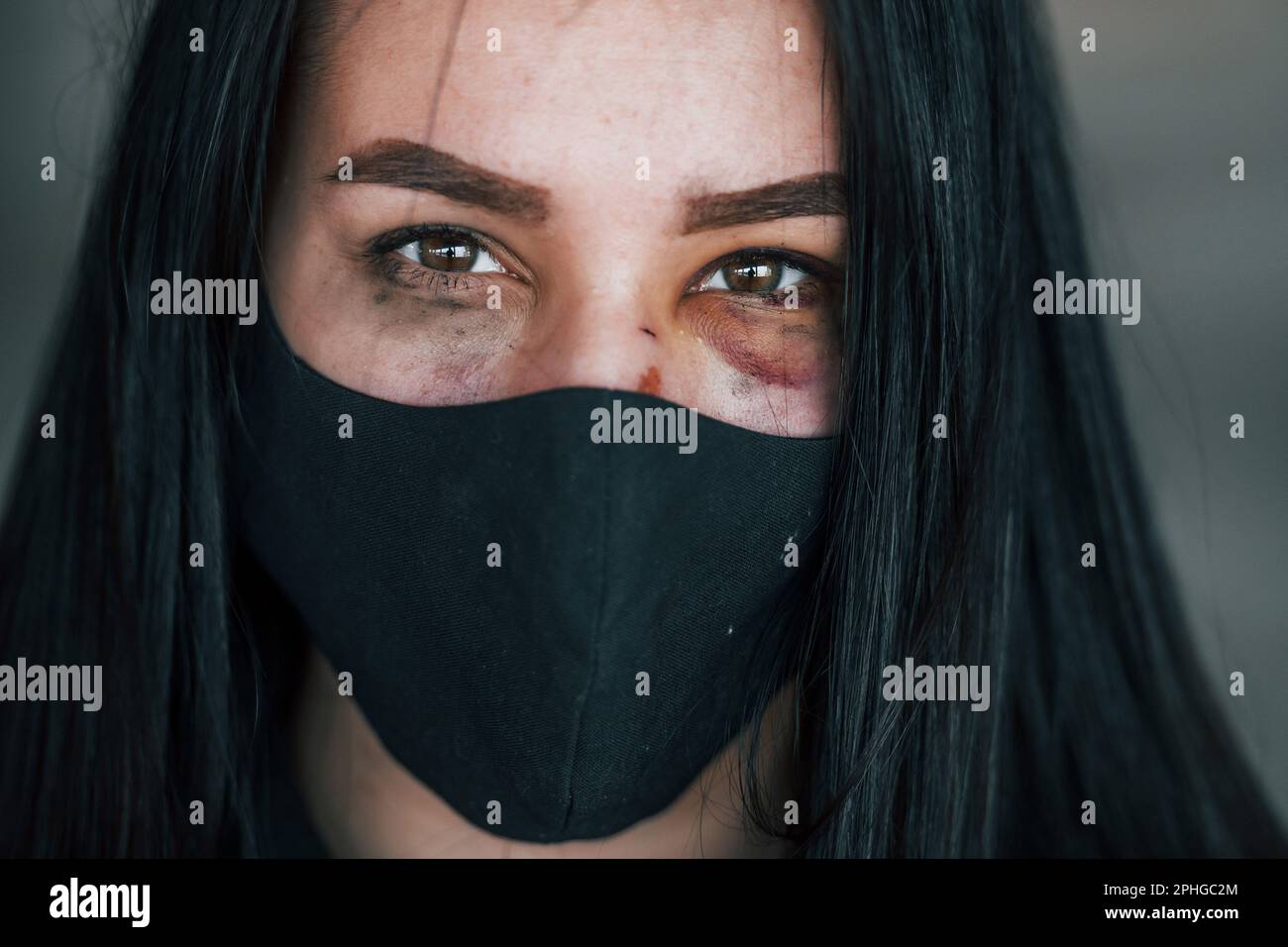 Portrait of beaten young woman in black protective mask with bruise ...