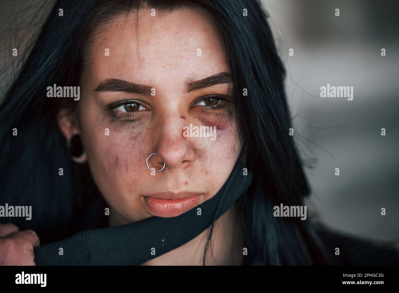 Portrait of beaten young woman in black protective mask with bruise ...
