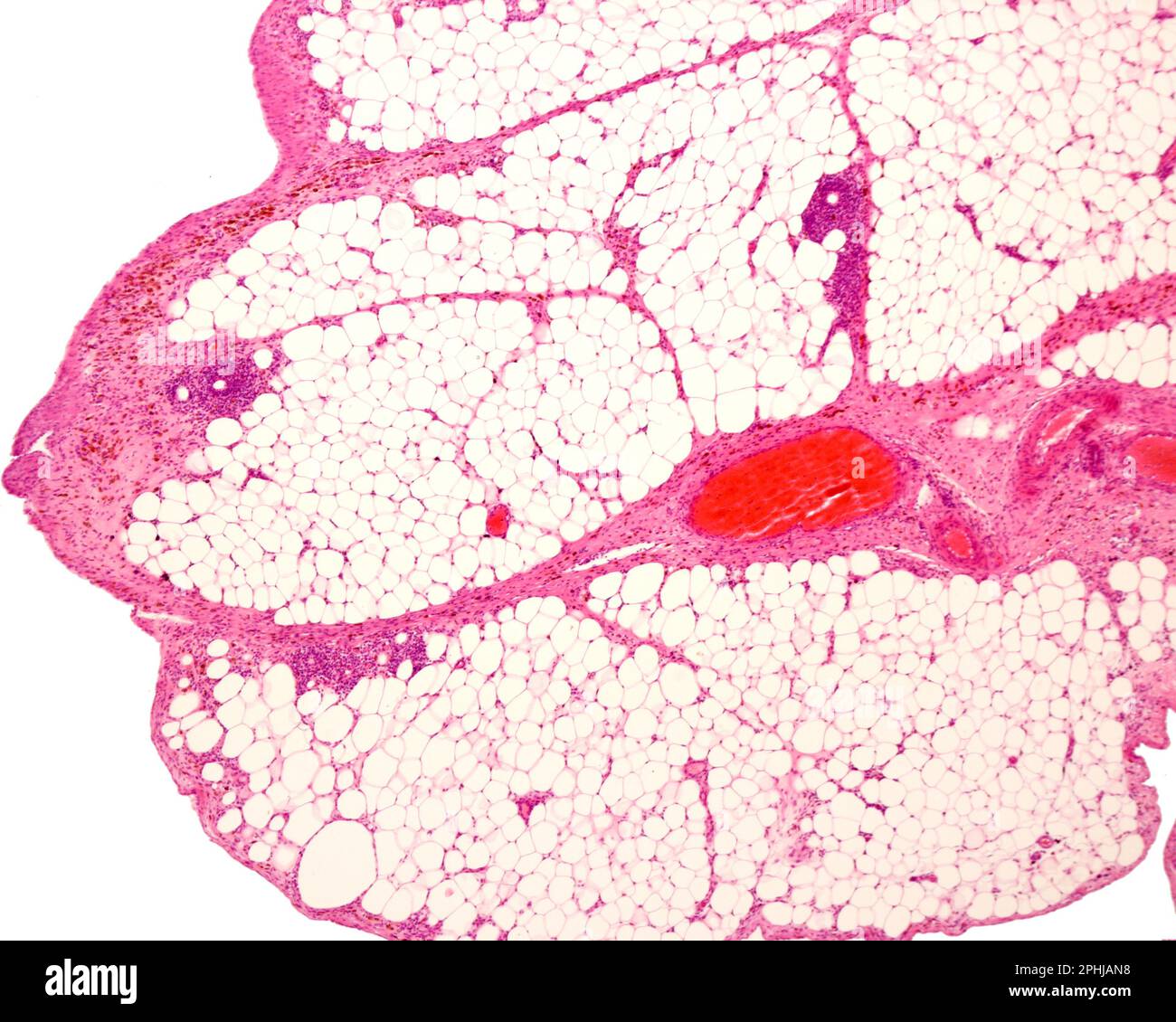 White adipose tissue, light micrograph Stock Photo - Alamy