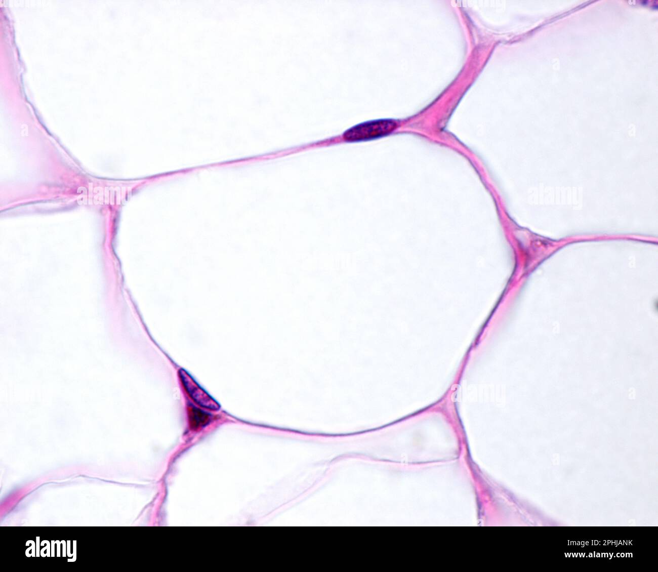 Adipocytes, light micrograph Stock Photo - Alamy