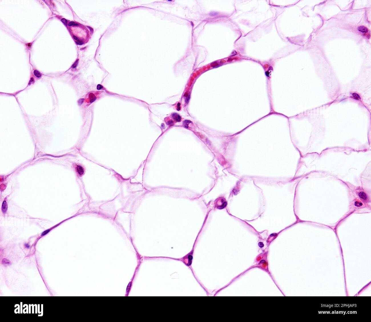 Adipocytes, light micrograph Stock Photo - Alamy
