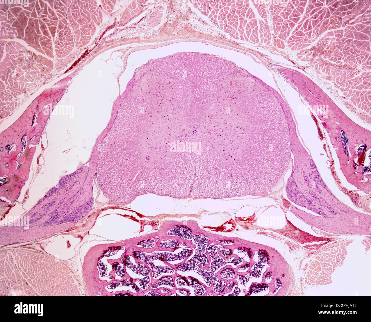 Spinal cord and dorsal root ganglion, light micrograph Stock Photo Alamy