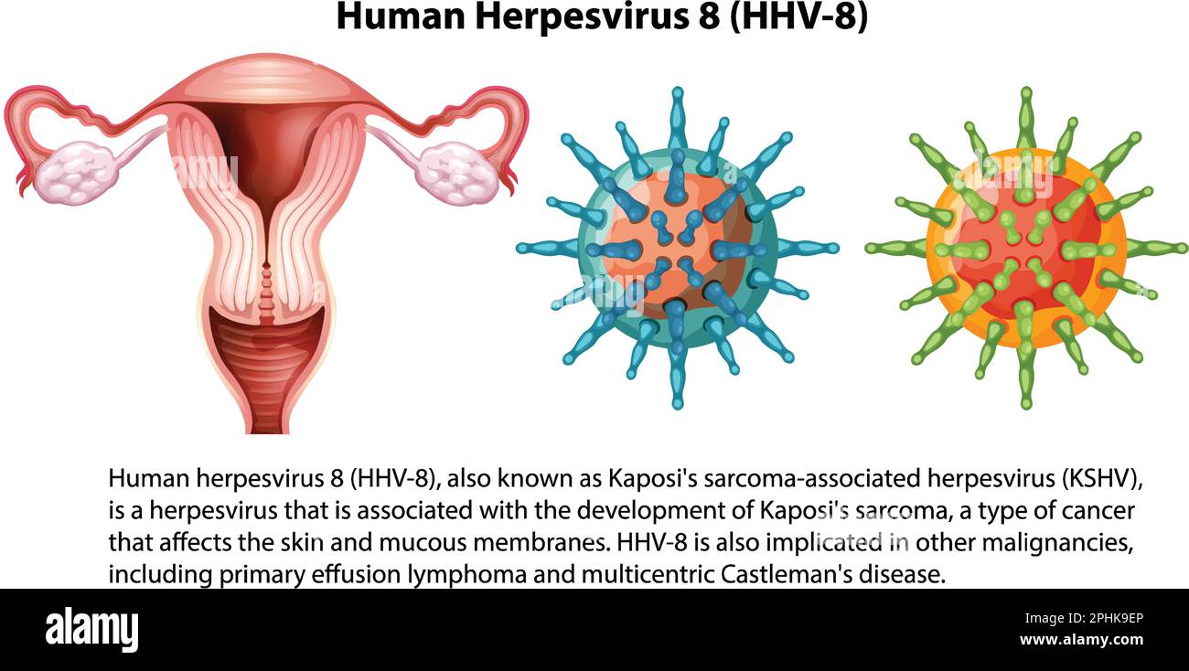 Human Herpesvirus 8 (HHV 8) illustration Stock Vector