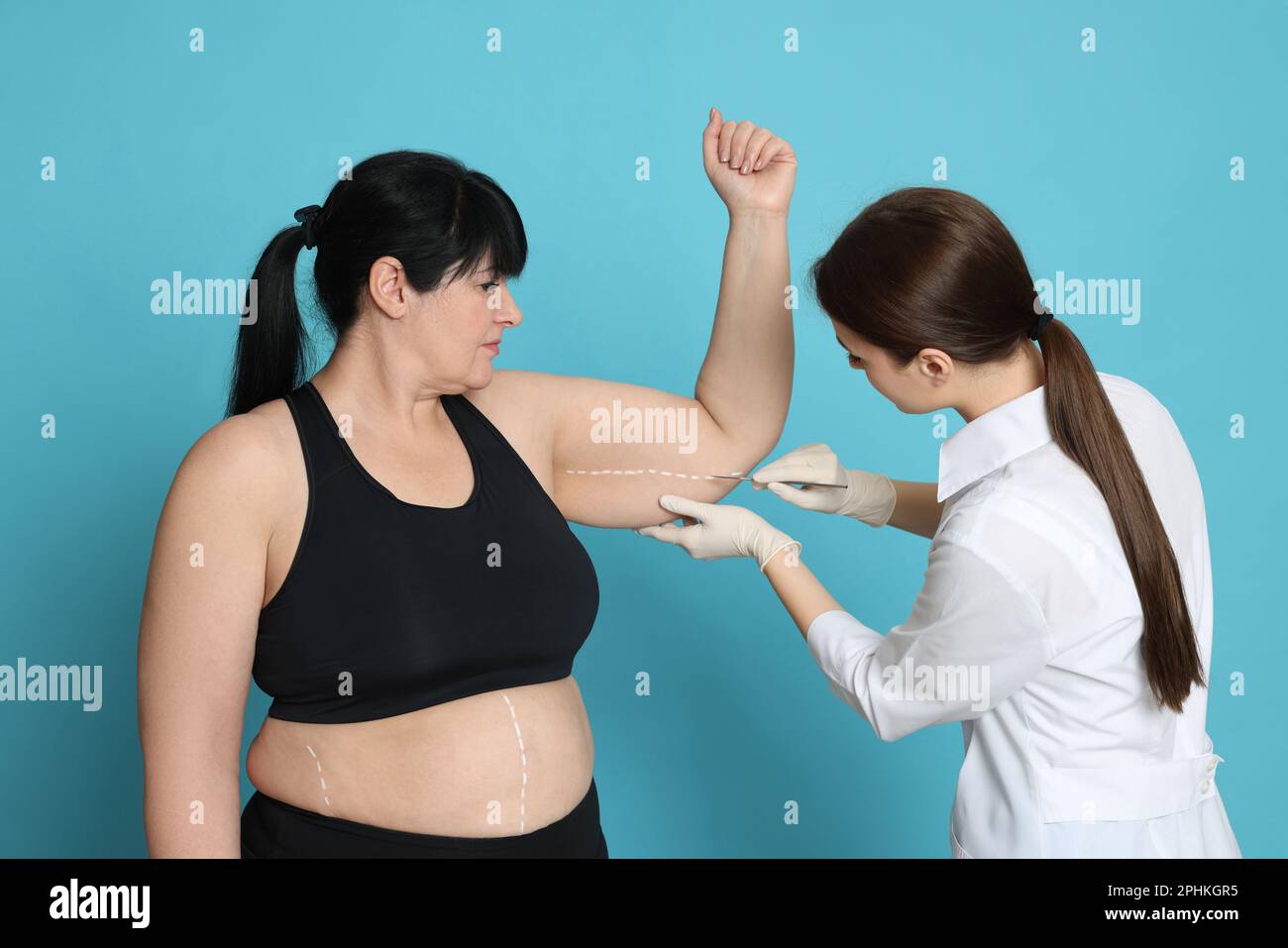 Doctor with scalpel near obese woman on light blue background. Weight loss surgery Stock Photo
