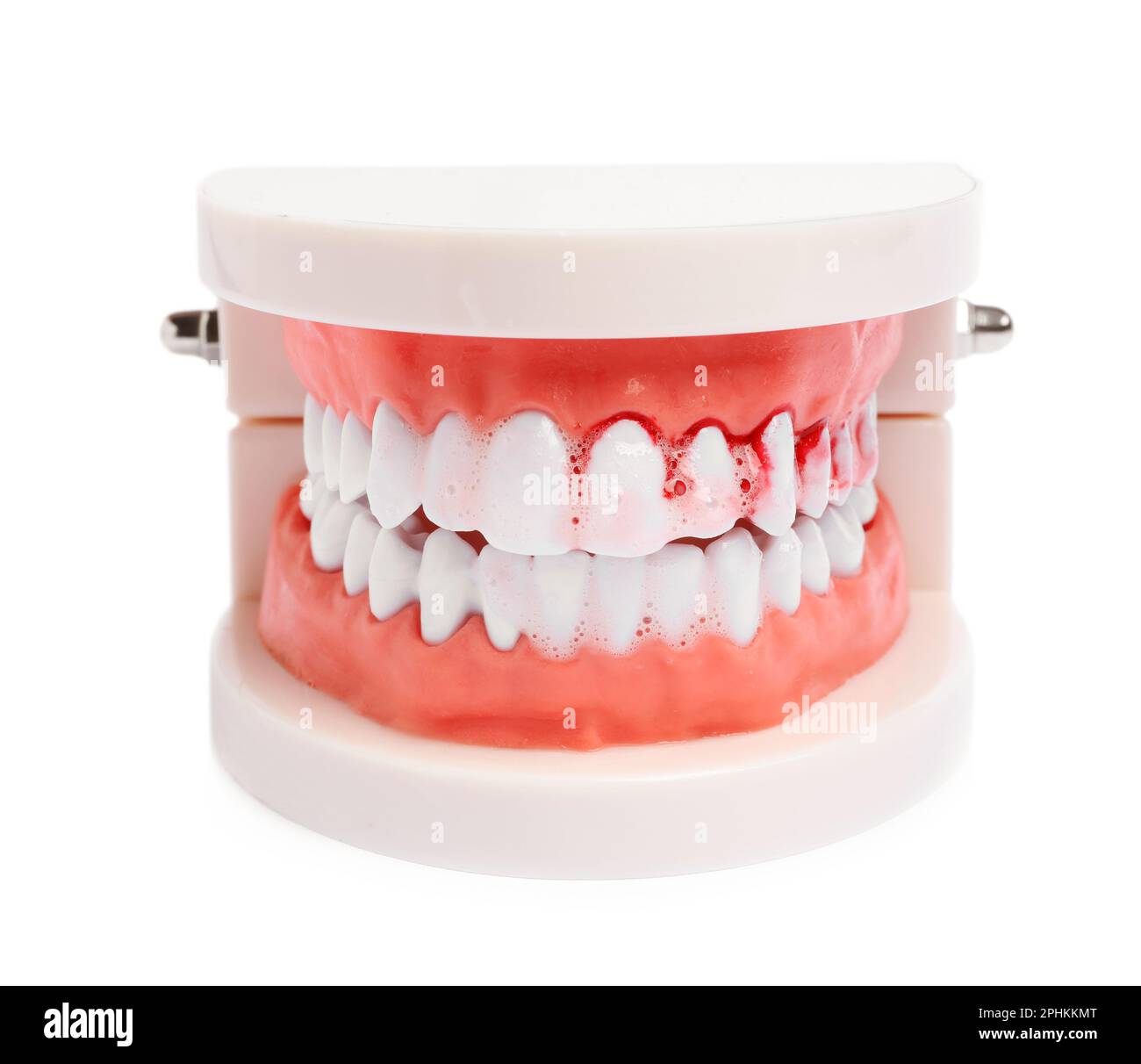 Model of jaw and toothpaste foam with blood on white background. Gum problems Stock Photo