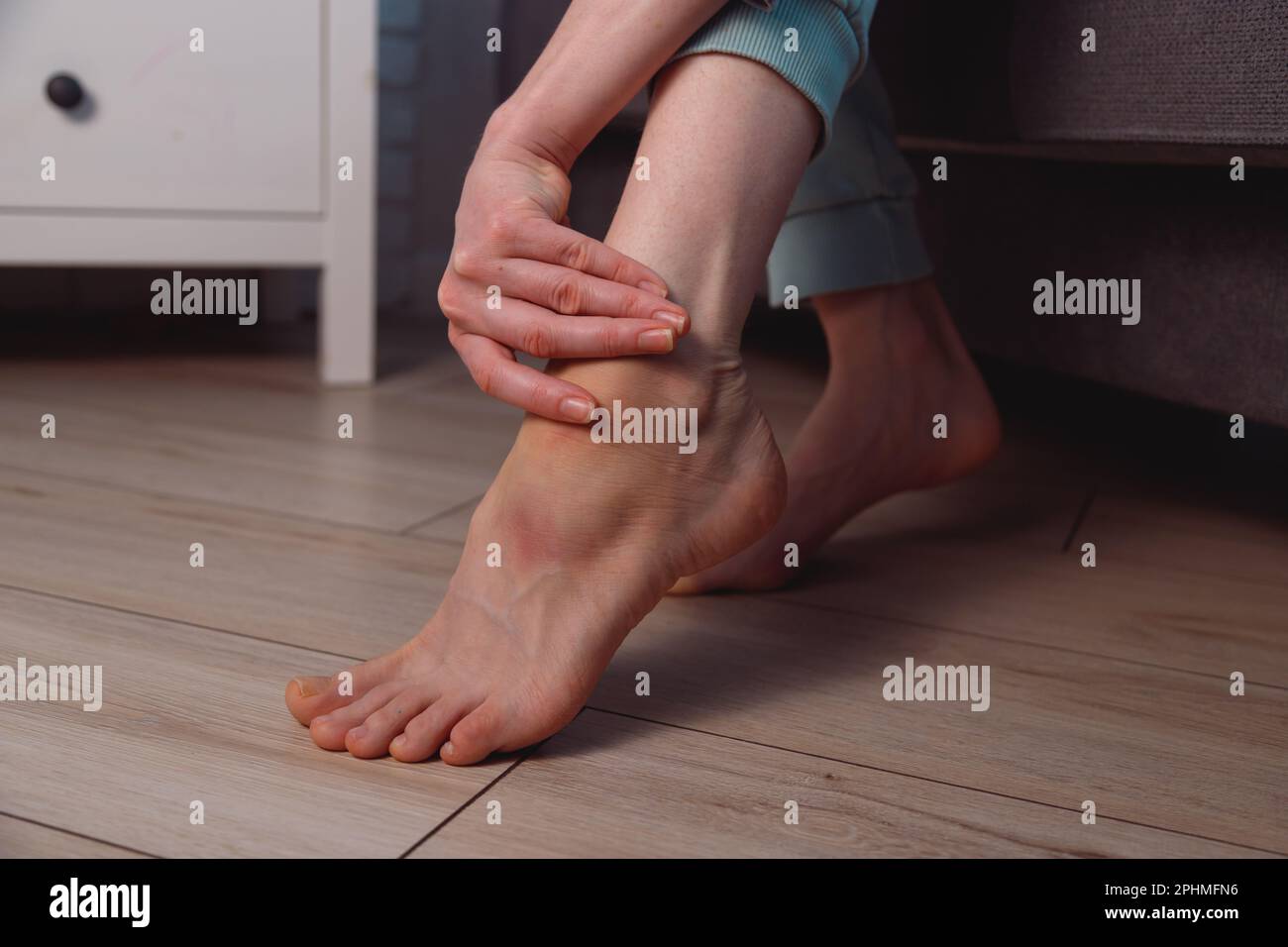 Woman apply ointment on ankle with bruise and swelling on her foot at