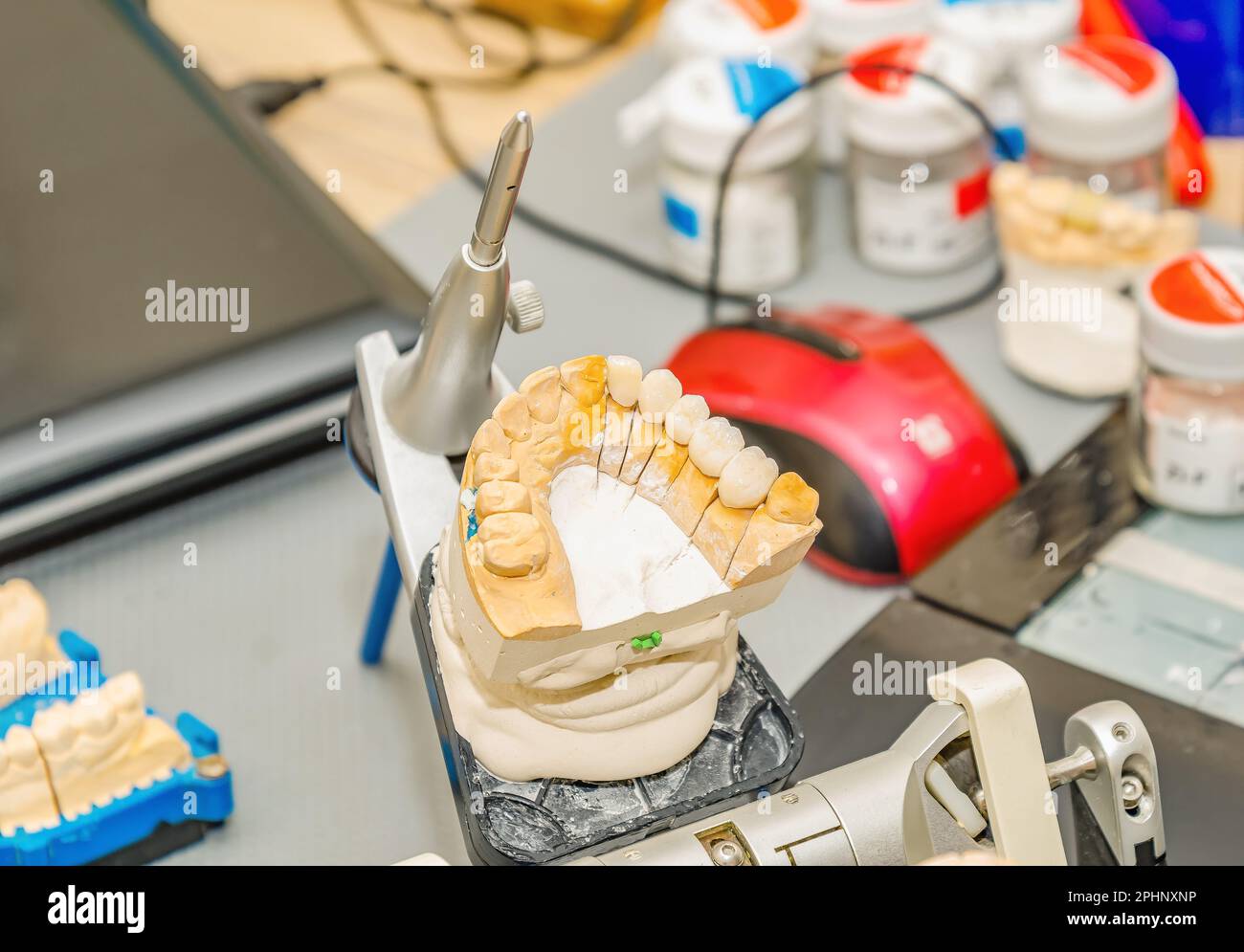 Plaster cast of the jaw in office of a dental technician Stock Photo