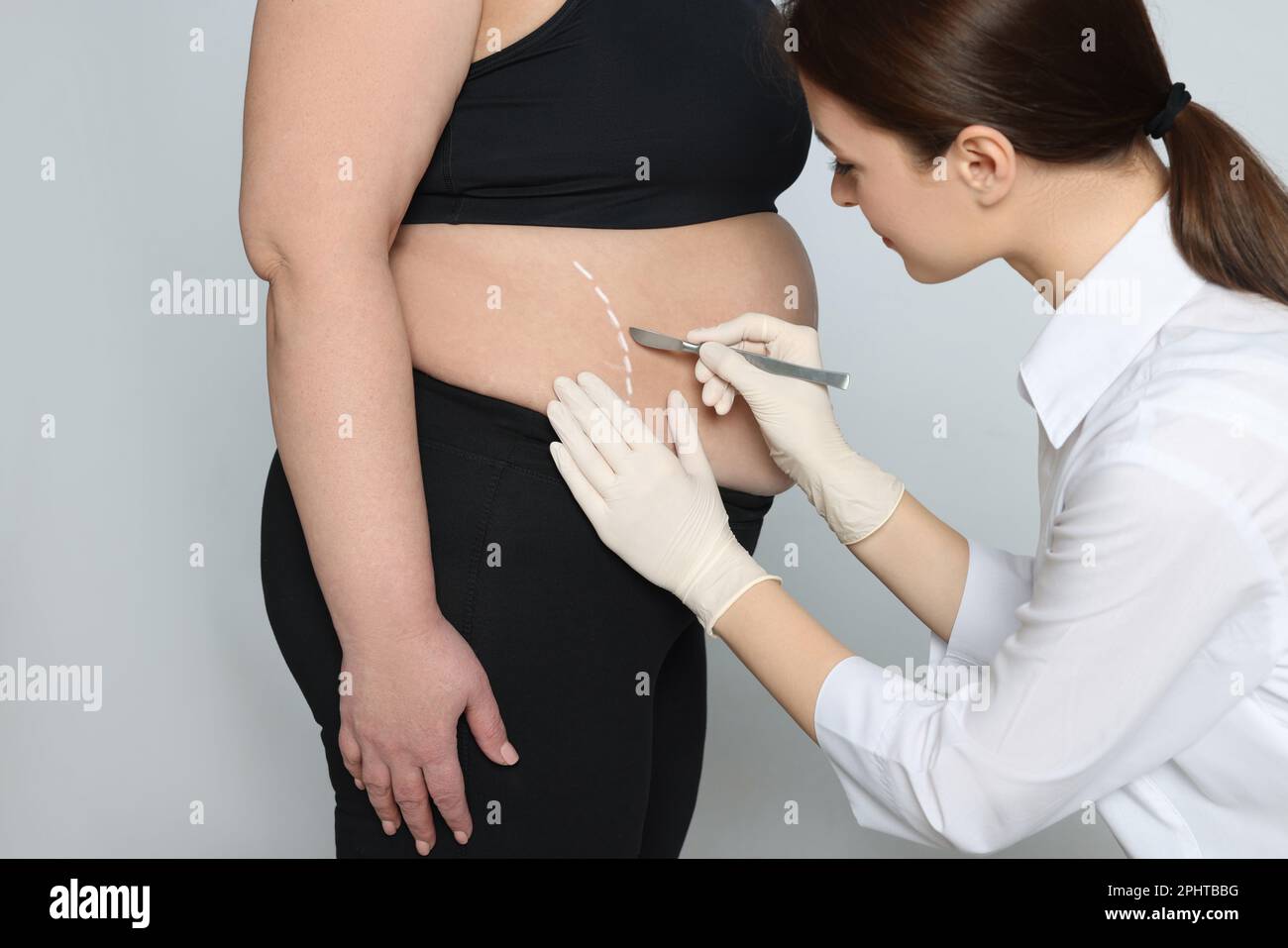 Obese woman with flabby arm on white background. Weight loss surgery Stock  Photo - Alamy