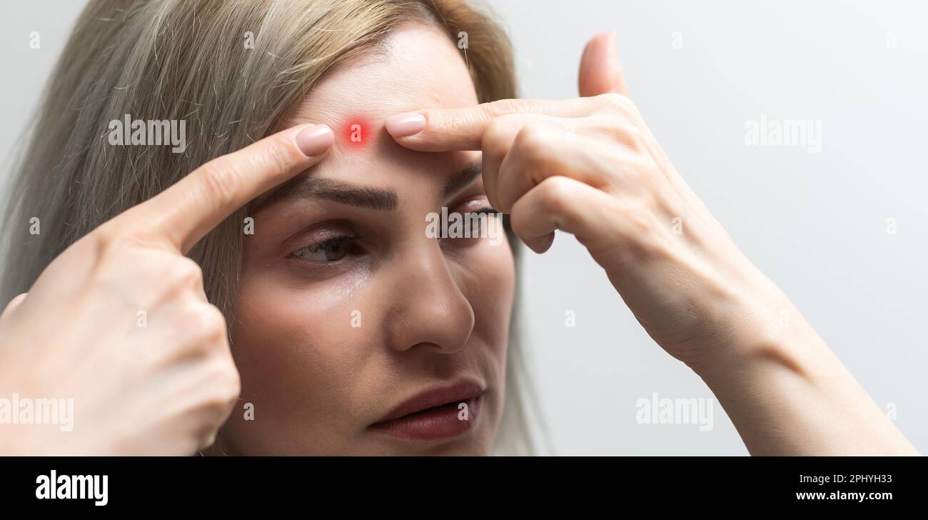 Dermatology, scratch asian young woman looking at mirror, expression