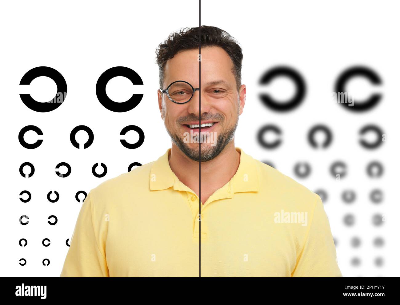 Collage with photos of man with and without glasses and eye charts on