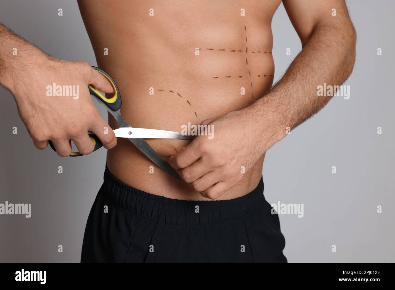 Fit man with scissors and marks on body against grey background, closeup. Weight loss surgery Stock Photo