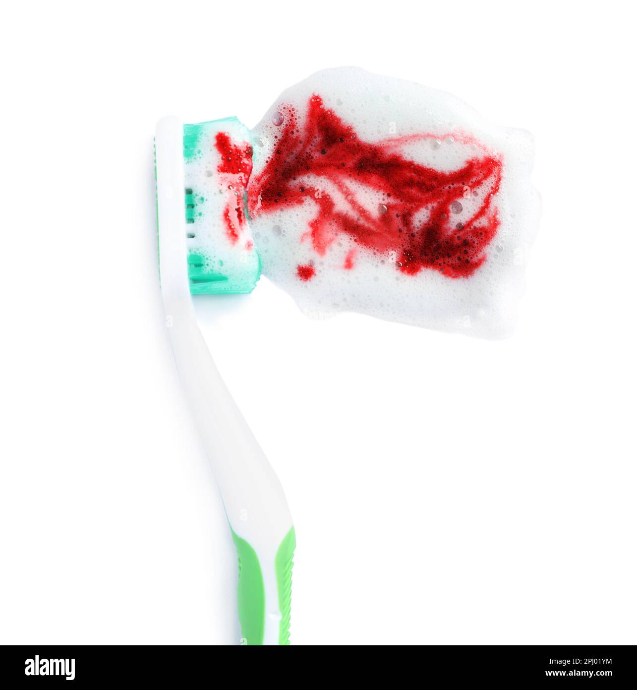 Toothbrush with paste and blood on white background, top view. Gum