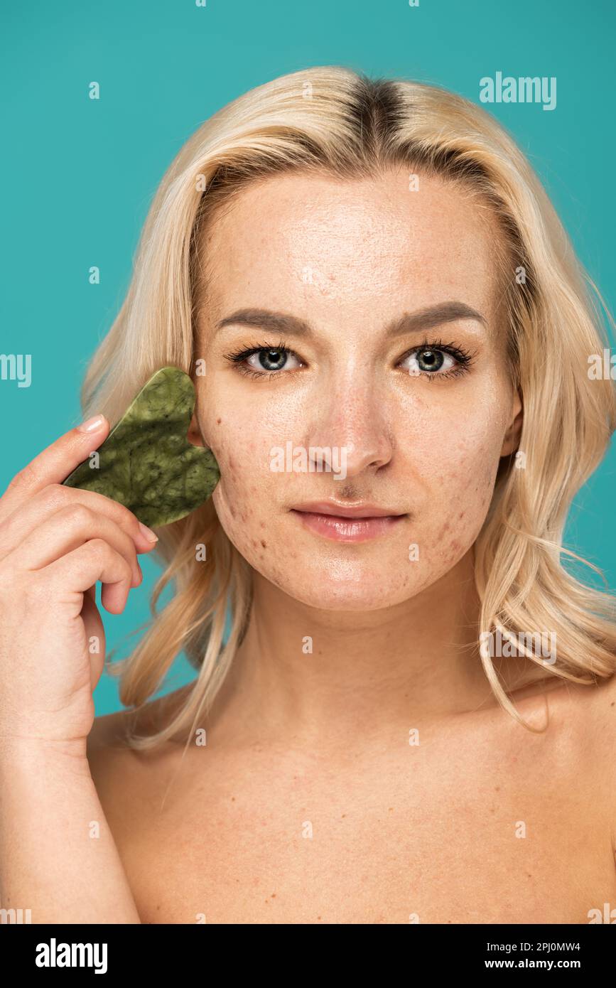 blonde woman with blemishes massaging face with face scraper isolated on turquoise,stock image Stock Photo