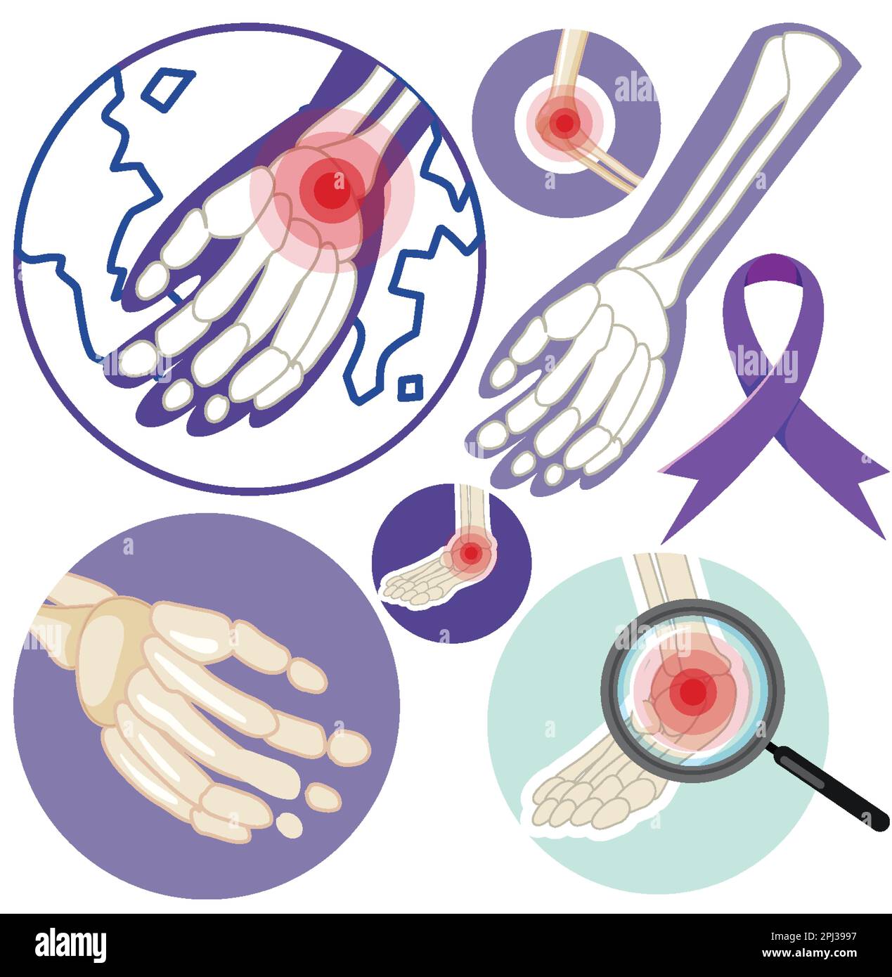 Set of Arthritis sign illustration Stock Vector Image & Art - Alamy