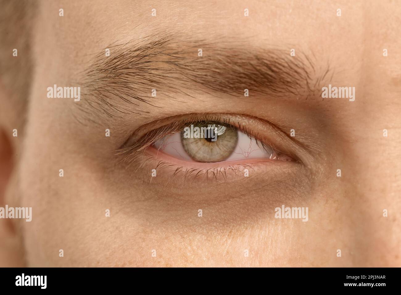 Tired man with dark circle under eye, closeup Stock Photo Alamy