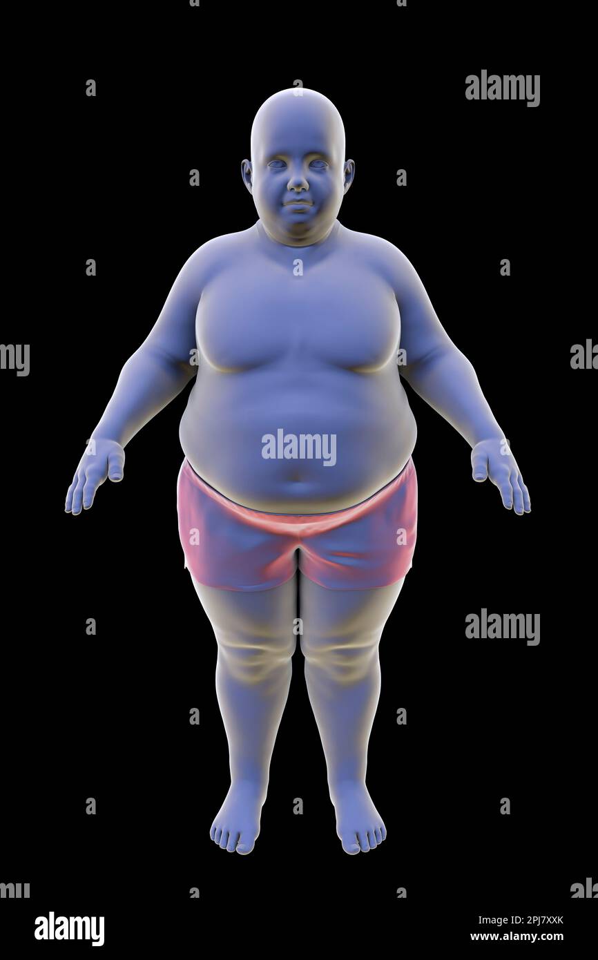 Obese Boy Illustration Stock Photo Alamy cartoon-character-of-an-obese-groundhog-wearing-yellow-t-shirt-and-blue