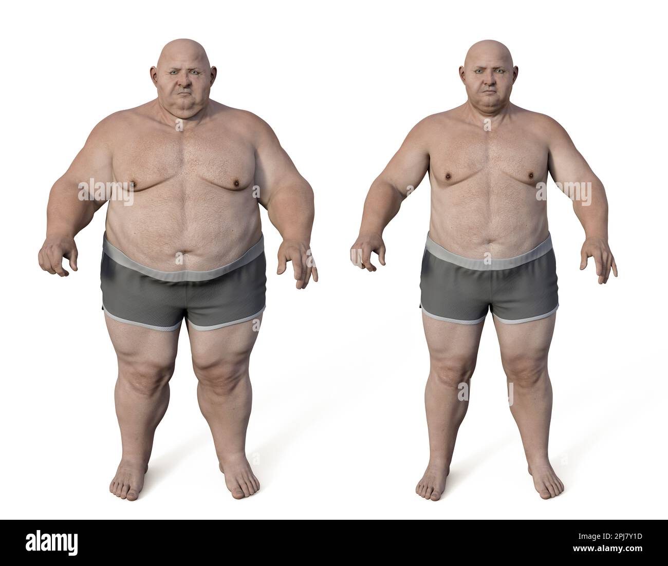 Man Before And After Gaining Weight Illustration Stock Photo Alamy Man before and after gaining weight illustration stock photo alamy