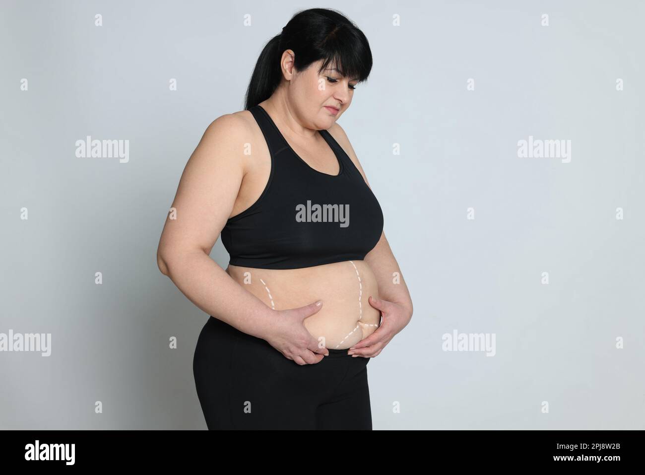 Woman grabbing skin on her flanks with the black color crosses marking,  Lose weight and liposuction cellulite removal concept, Isolated on white  backg Stock Photo - Alamy